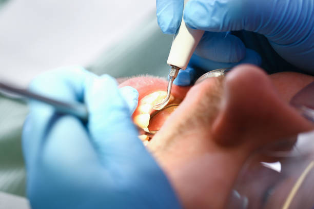 Best Orthodontic Emergency Dentist in De Graff, OH