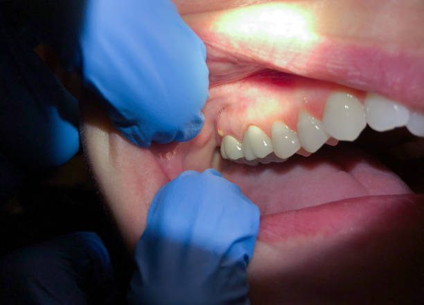 Best Broken or Cracked Tooth Emergency Dentist in De Graff, OH